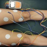 Electrostimulation