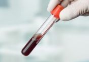 Analyse de sang : l’ionogramme sanguin
